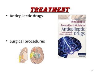 TREATMEnT
• Antiepilectic drugs




• Surgical procedures




                         50
 
