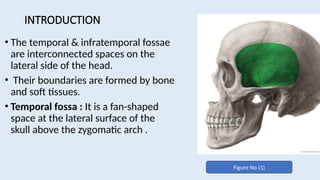 Comprehensive Anatomy of Temporal and Infratemporal Fossae: Boundaries ...