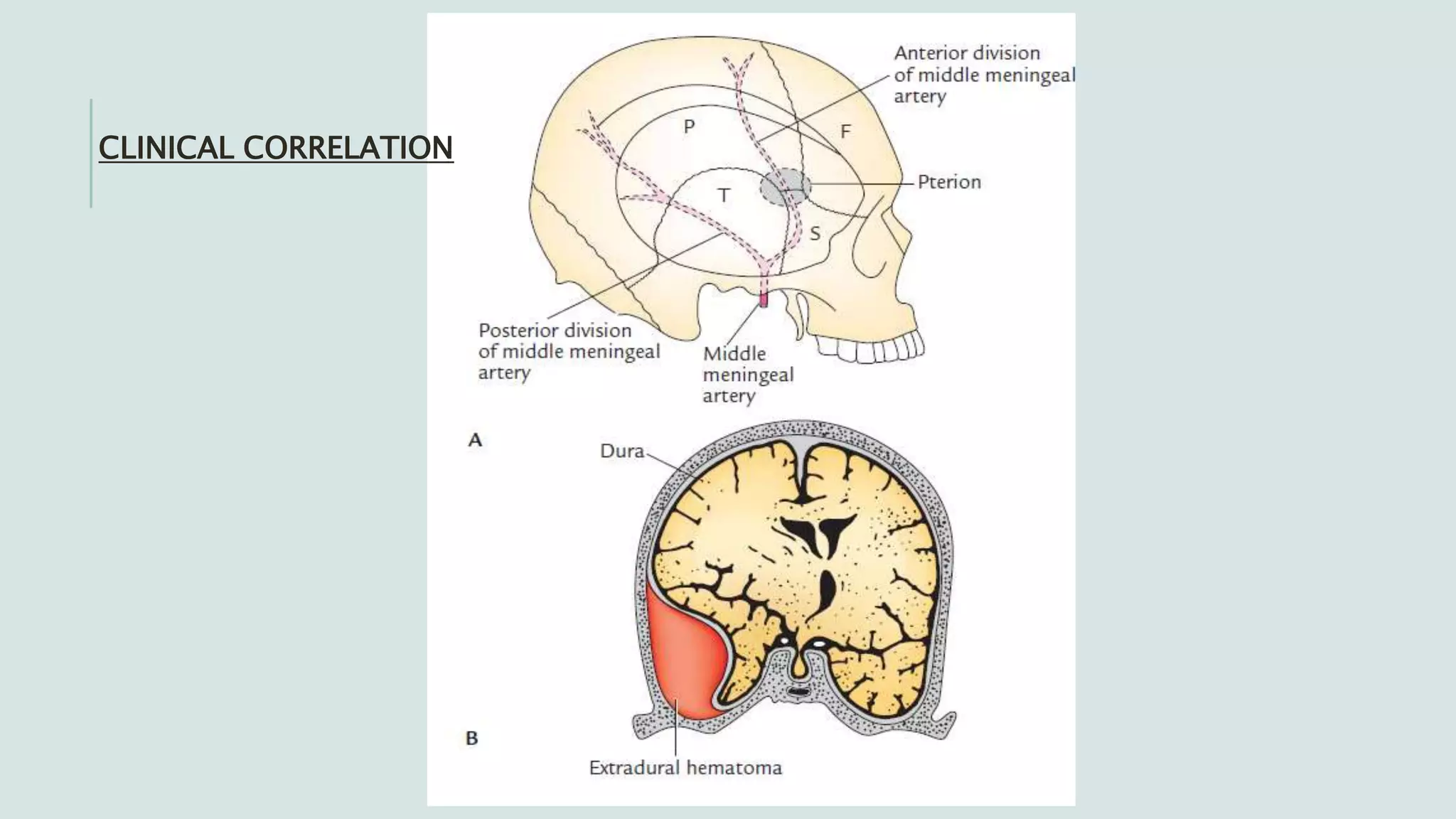 Temporal and infratemporal regions | PPTX