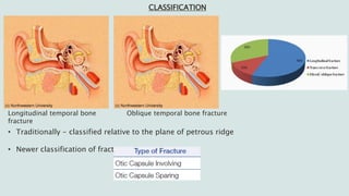 Temporal and infratemporal regions | PPTX