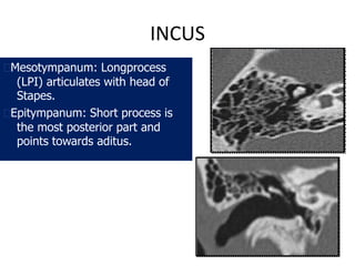 Temporal bone radiology | PPTX