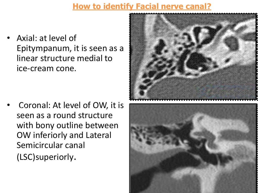 Temporal bone radiology