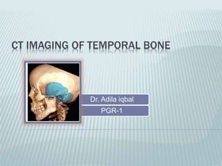 CT IMAGING OF TEMPORAL BONE
Dr. Adila iqbal
PGR-1
 