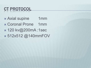 CT PROTOCOL
 Axial supine 1mm
 Coronal Prone 1mm
 120 kv@200mA :1sec
 512x512 @140mmFOV
 