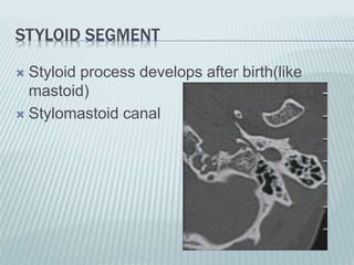 STYLOID SEGMENT
 Styloid process develops after birth(like
mastoid)
 Stylomastoid canal
 