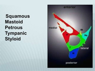 Squamous
Mastoid
Petrous
Tympanic
Styloid
 
