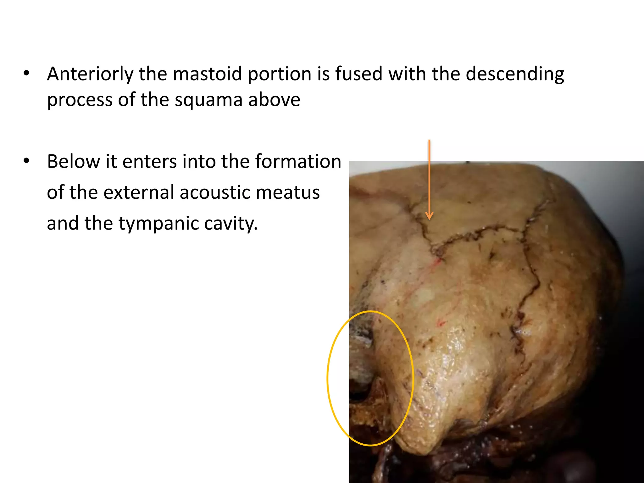 • Anteriorly the mastoid portion is fused with the descending
process of the squama above
• Below it enters into the formation
of the external acoustic meatus
and the tympanic cavity.
 