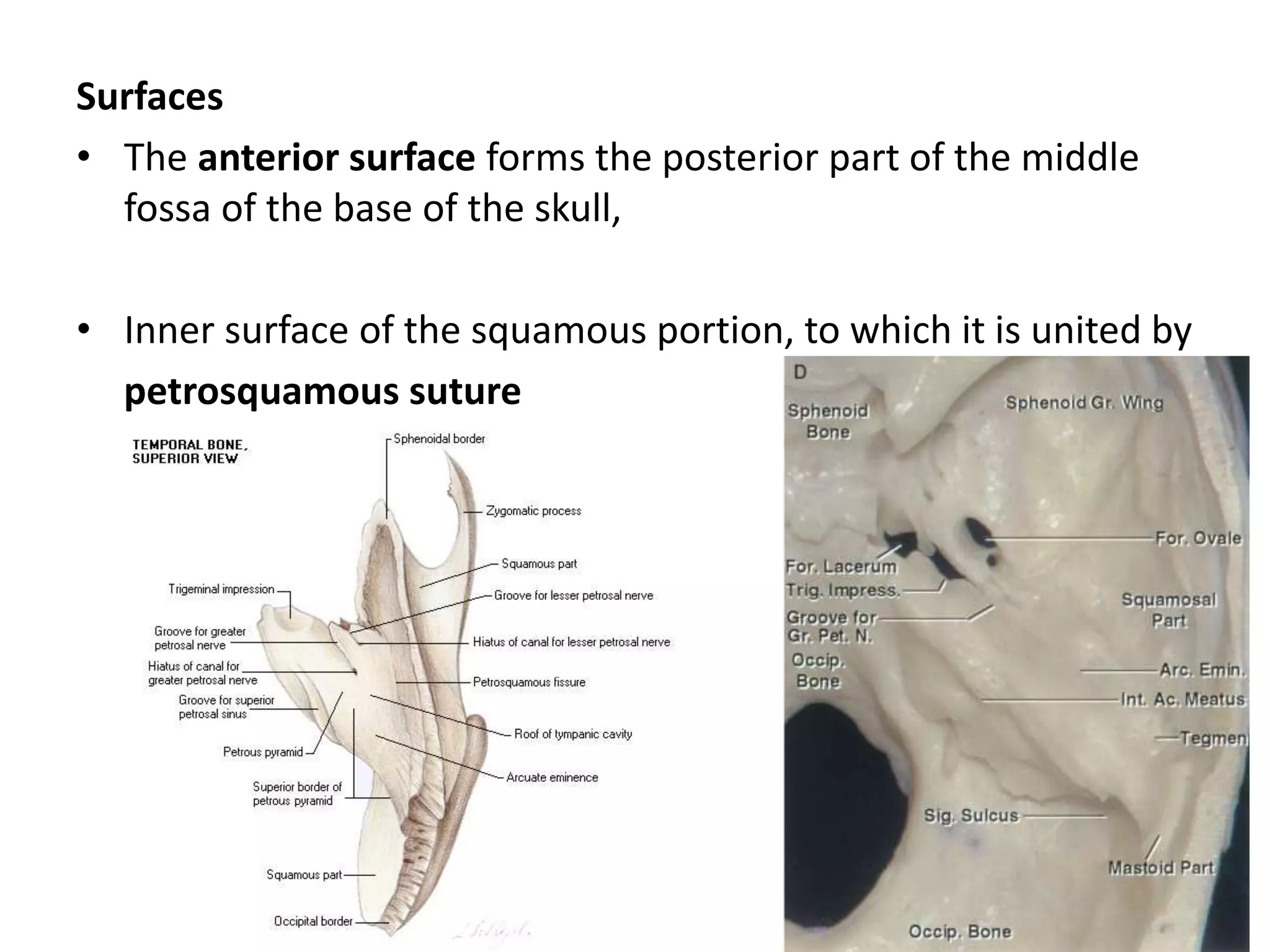 Surfaces
• The anterior surface forms the posterior part of the middle
fossa of the base of the skull,
• Inner surface of the squamous portion, to which it is united by
petrosquamous suture
 