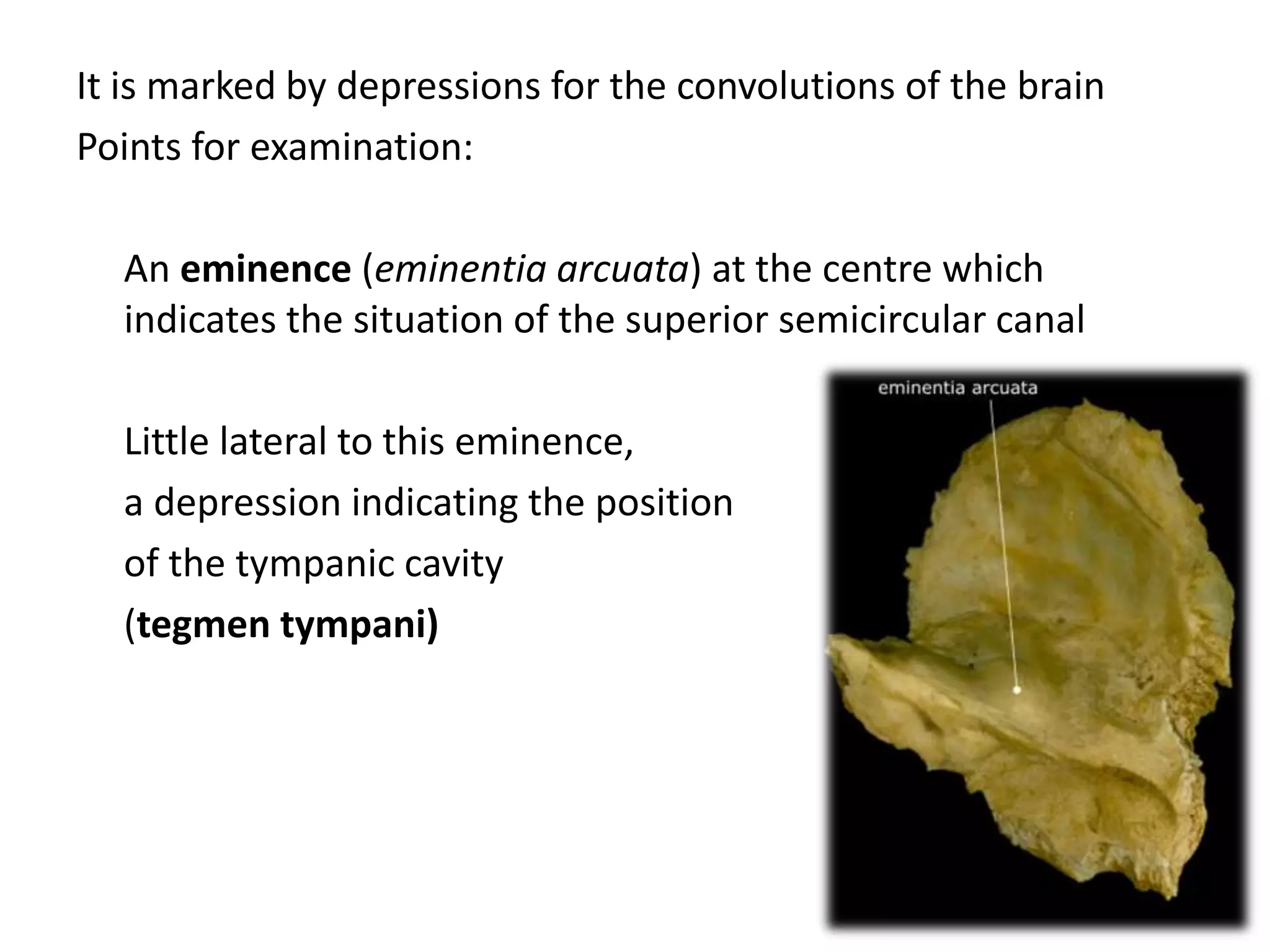 It is marked by depressions for the convolutions of the brain
Points for examination:
An eminence (eminentia arcuata) at the centre which
indicates the situation of the superior semicircular canal
Little lateral to this eminence,
a depression indicating the position
of the tympanic cavity
(tegmen tympani)
 