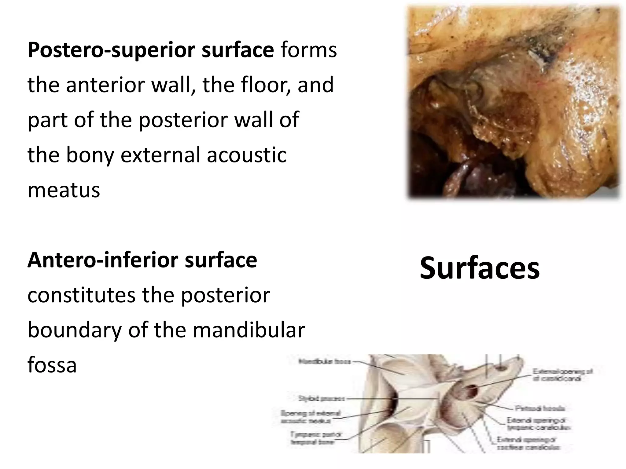 Surfaces
Postero-superior surface forms
the anterior wall, the floor, and
part of the posterior wall of
the bony external acoustic
meatus
Antero-inferior surface
constitutes the posterior
boundary of the mandibular
fossa
 