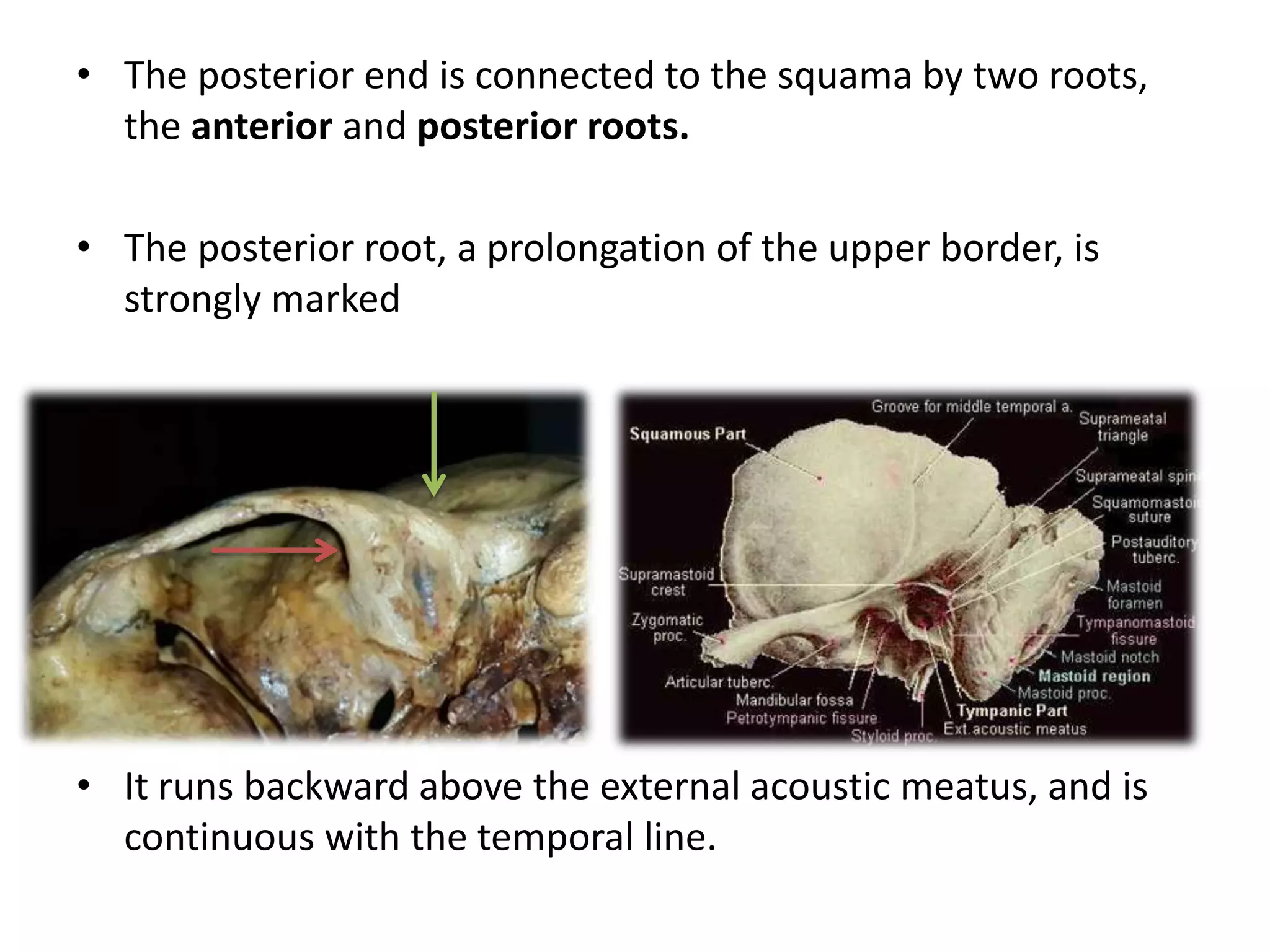 • The posterior end is connected to the squama by two roots,
the anterior and posterior roots.
• The posterior root, a prolongation of the upper border, is
strongly marked
• It runs backward above the external acoustic meatus, and is
continuous with the temporal line.
 