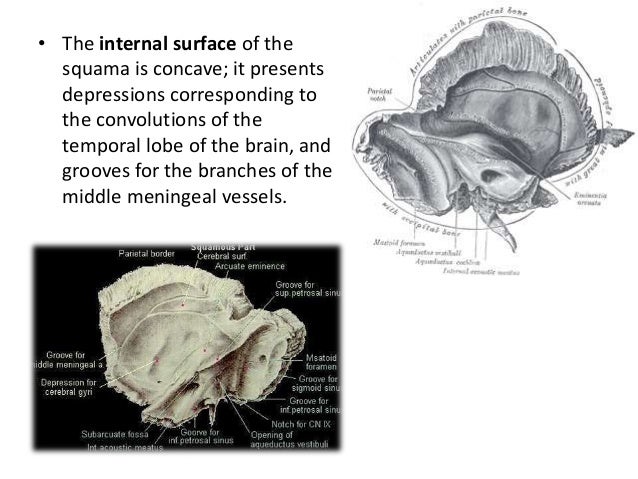 Temporal bone1