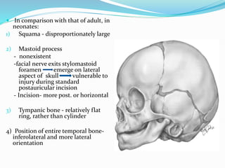 Temporal bone anatomy and surgical significancepptx | PPTX