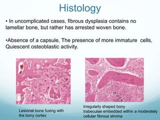 Temporal bone neoplasms | PPTX