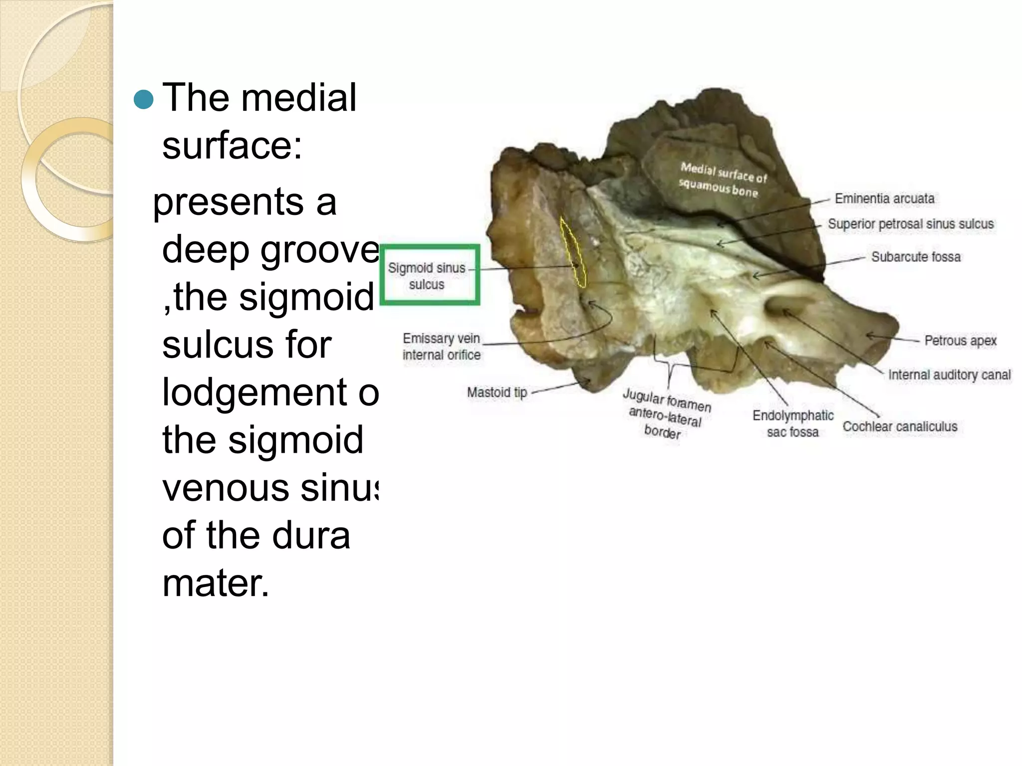 ⚫ The medial
surface:
presents a
deep groove
,the sigmoid
sulcus for
lodgement of
the sigmoid
venous sinus
of the dura
mater.
 