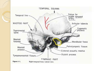 Temporal Bone anatomy ppt.pptx
