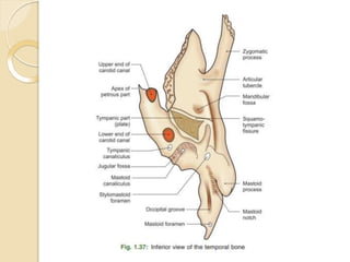 Temporal Bone anatomy ppt.pptx