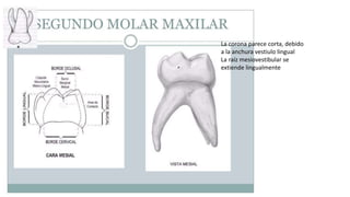 La corona parece corta, debido
a la anchura vestiulo lingual
La raíz mesiovestibular se
extiende lingualmente
 
