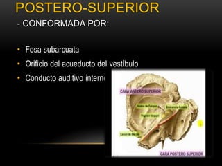 POSTERO-SUPERIOR
- CONFORMADA POR:
• Fosa subarcuata
• Orificio del acueducto del vestíbulo
• Conducto auditivo interno
 
