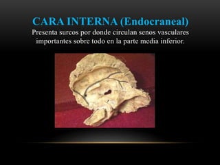 CARA INTERNA (Endocraneal)
Presenta surcos por donde circulan senos vasculares
importantes sobre todo en la parte media inferior.
 