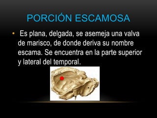 PORCIÓN ESCAMOSA
• Es plana, delgada, se asemeja una valva
de marisco, de donde deriva su nombre
escama. Se encuentra en la parte superior
y lateral del temporal.
 