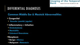 DIFFERENTIAL DIAGNOSES
Common Middle Ear & Mastoid Abnormalities
 Congenital
 Vascular (carotid, jugular)
 Inflammatory – Infection
 Cholesteatoma
 Mastoiditis
 Colesterol Granuloma
Neoplasm
 Benign : Glomus
 Malignant : Metastasis
 