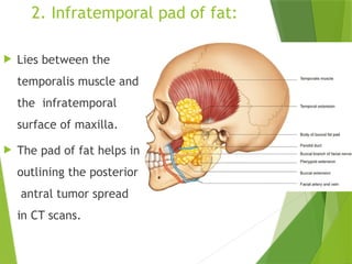 Anatomy of temporal & infratemporal fossa.pptx