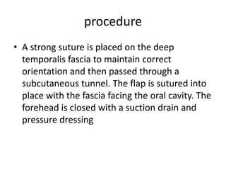 Temporalis muscle flap