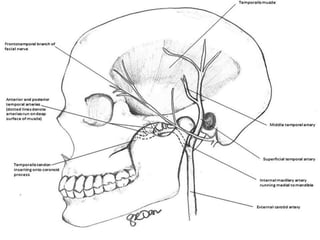Temporalis muscle flap