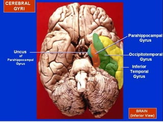 Temporal Functions temporal lobe anatomy class - Detailed anatomy | PPTX