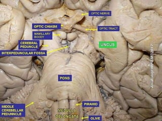 temporal lobe anatomy class - Detailed anatomy | PPTX