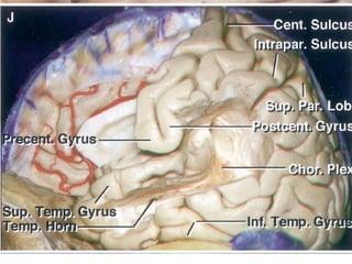 Temporal Functions temporal lobe anatomy class - Detailed anatomy | PPTX