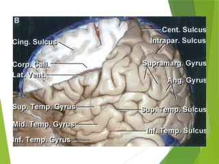 Lower Temporal Temporal Lobe Anatomy neurosurgery fINAL.pptx