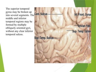 Temporal Gyrus Function Temporal Lobe Anatomy neurosurgery fINAL.pptx