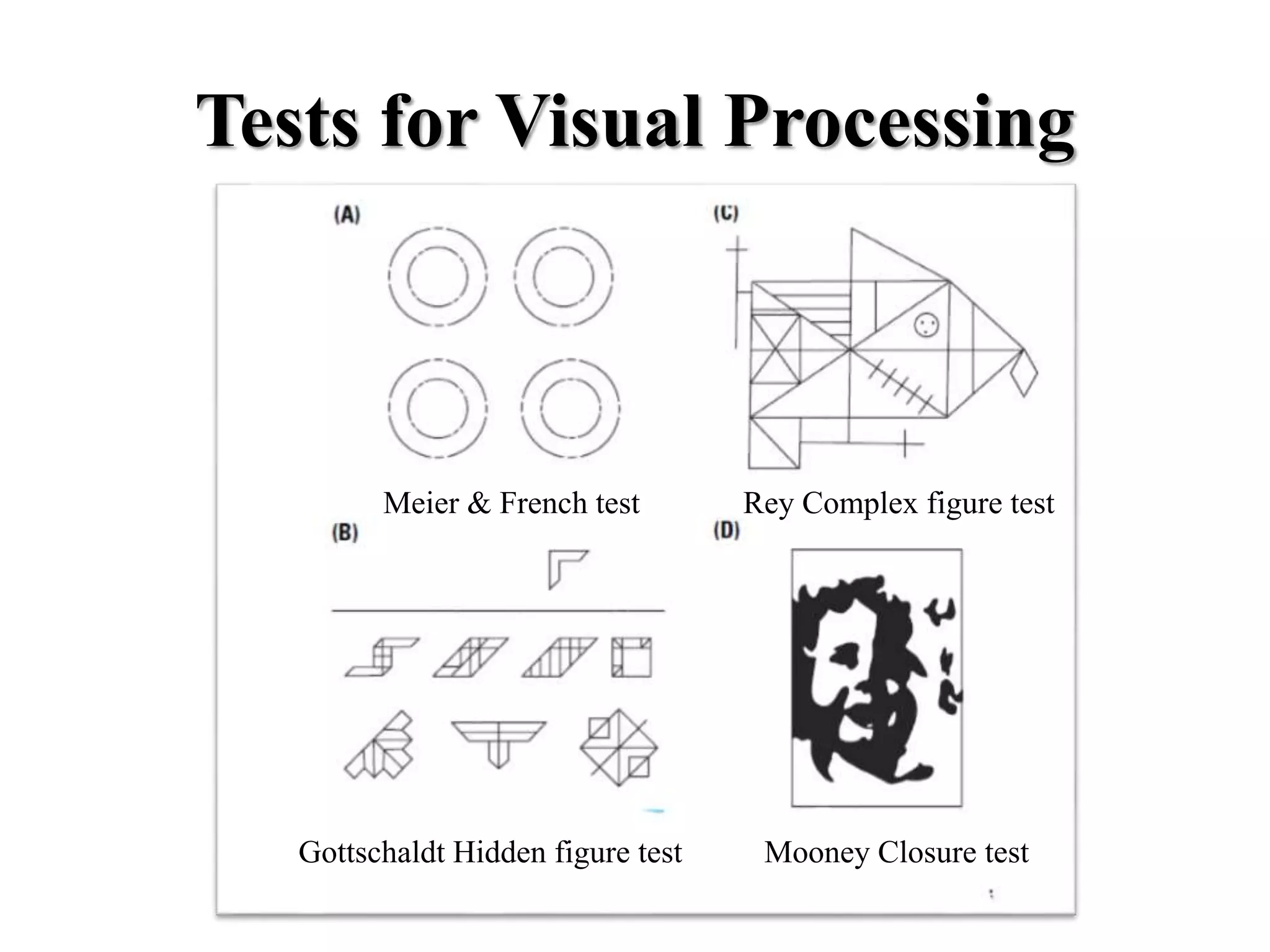 Visual Processing Screening Temporal lobe and its role in psychiatry | PPTX
