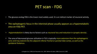 PET scan - FDG
• The glucose analog FDG is the tracer most widely used. It is an indirect marker of neuronal activity.
• The epileptogenic focus in the interictal phase usually appears as a hypometabolic
area on FDG-PET.
• Hypometabolism is likely due to factors such as neuronal loss and reduction in synaptic density .
• The area of decreased glucose utilization in TLE is typically more extensive than the epileptogenic
zone and may extend into the adjacent inferior frontal or parietal lobe cortex, as well as the
ipsilateral thalamus.
La fougère et al., 2009, Van Paesschen et al., 2007; Wehner & Lüders, 2008; Carne et al., 2007
 