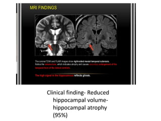 Temporal lobe epilepsy-Psychiatric aspects
