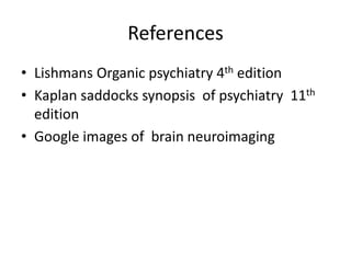 Temporal lobe epilepsy-Psychiatric aspects
