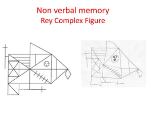 Non verbal memory
Rey Complex Figure
 