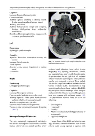 87
Cognitive
Memory: Korsakoff amnestic state
Cortical deafness
Auditory agnosia (inability to identify sounds
despite normal peripheral hearing status)
Auditory paracusias
Auditory hallucinations (simple and complex),
illusions (differentiate from peduncular
hallucinosis)
Disorders of time perception (time may pass with
excessive speed or not at all)
Left
Elementary
Right upper quadrantanopia
Cognitive
Aphasias: Wernicke’s, transcortical sensory, and
anomic
Memory: Verbal amnesia
Visual agnosia
Amusia: Lexical amusia (impairment in reading
music)
Synesthesia
Right
Elementary
Left upper quadrantanopia
Cognitive
Memory: Visuospatial amnesia
Prosopagnosia (occipital–temporal region)
Auditory agnosia—verbal (pure word deafness)
and nonverbal (environmental sounds)
Amusias—receptive and expressive
Delusional misidentiﬁcation syndromes
Theory of mind impairment (semantic dementia)
[10–17]
Neuropathological Processes
The more commonly encountered pathologies
that involve the temporal lobe in relative isolation
include inferior division middle cerebral artery
territory bland infarction, intracerebral hemor-
rhage (Fig. 5.5), epilepsy, encephalitis, tumors,
and traumatic brain injury. Aside from the apha-
sic presentations that are typical of left temporal
lobe involvement, right temporal lobe syndromes
may be more enigmatic or covert. These include
Kluver–Bucy syndrome (KBS) and Geschwind-
Gastaut syndrome (GGS) presentations or frag-
ments thereof or forme fruste varieties. The KBS,
originally described in monkeys, is rare and gen-
erally ascribed to bilateral lesions although cases
have been reported with unilateral lesions [18].
The presentation includes some or all of the
following:
• Visual agnosia
• Hyperorality
• Placidity
• Altered sexual activity both hypersexuality or
hyposexuality
• Hypermetamorphosis
Human forms of the KBS are being increas-
ingly described with manifestations such as com-
pulsive social kissing reported in a person with
Fig. 5.5 Isolated, discrete, right temporal lobe intracere-
bral hemorrhage (arrow)
Temporal Lobe Elementary Neurological, Cognitive, and Behavioral Presentations and Syndromes
 