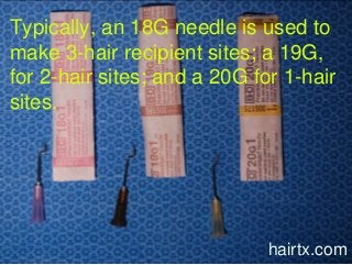 Typically, an 18G needle is used to
make 3-hair recipient sites; a 19G,
for 2-hair sites; and a 20G for 1-hair
sites.
hairtx.com
 