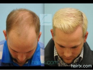 hairtx.com
 