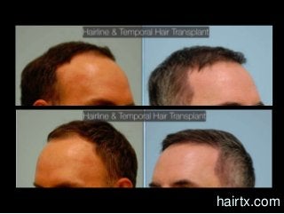 hairtx.com
 