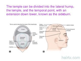 The temple can be divided into the lateral hump,
the temple, and the temporal point, with an
extension down lower, known as the sideburn.
hairtx.com
 