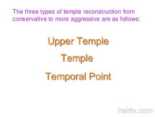 Upper Temple
Temple
Temporal Point
The three types of temple reconstruction from
conservative to more aggressive are as follows:
hairtx.com
 