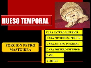HUESO TEMPORAL
PORCION PETRO
MASTOIDEA
CARAANTERO SUPERIOR
CARA POSTERO SUPERIOR
CARAANTERO INFERIOR
CARA POSTERO INFERIOR
BASE
VERTICE
 