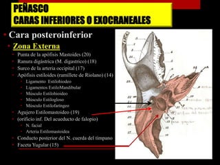 PEÑASCO
CARAS INFERIORES O EXOCRANEALES
• Cara posteroinferior
• Zona Externa
• Punta de la apófisis Mastoides (20)
• Ranura digástrica (M. digastrico) (18)
• Surco de la arteria occipital (17)
• Apófisis estiloides (ramillete de Riolano) (14)
• Ligamento Estilohiodeo
• Ligamentos EstiloMandibular
• Músculo Estilohioideo
• Músculo Estilogloso
• Músculo Estilofaríngeo
• Agujero Estilomastoideo (19)
• (orificio inf. Del acueducto de falopio)
• N. facial
• Arteria Estilomastoidea
• Conducto posterior del N. cuerda del tímpano
• Faceta Yugular (15)
 