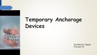 Temporary Anchorage
Devices
Dr.Lekshmi G Vijayan
First year PG
 