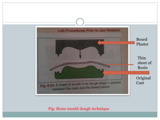 Boxed
Plaster
Original
Cast
Thin
sheet of
Resin
Fig: Stone mould dough technique
 