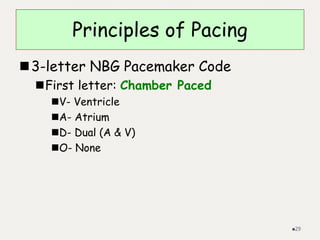 Principles of Pacing
3-letter NBG Pacemaker Code
First letter: Chamber Paced
V- Ventricle
A- Atrium
D- Dual (A & V)
O- None
29
 